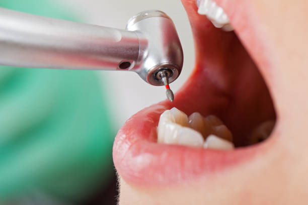 Best Emergency Broken Tooth Repair in Eveleth, MN